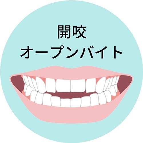 開咬
