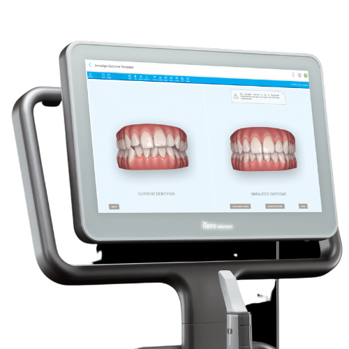 マウスピース矯正のAIシステム - 奈良北葛城矯正歯科相談室