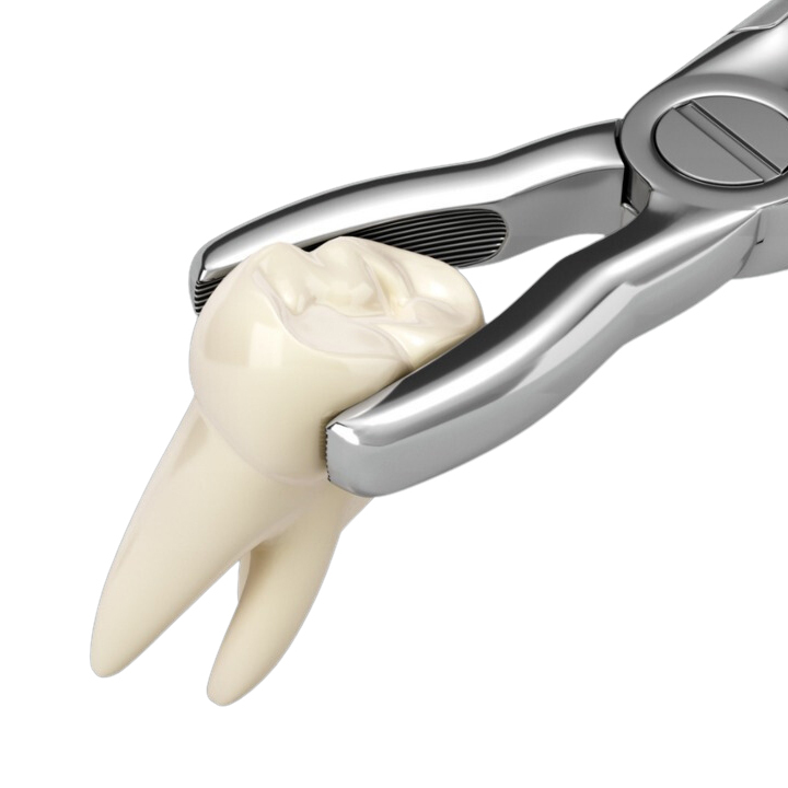 抜歯しない小児矯正 