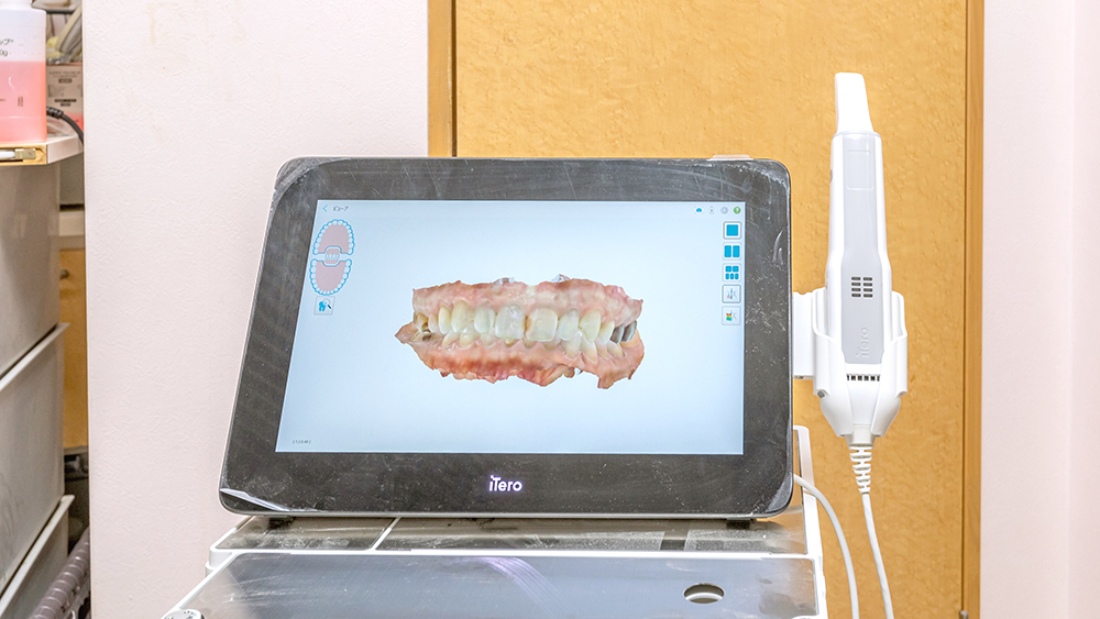 インビザラインでシミュレーション- 奈良県北葛城 矯正歯科相談室