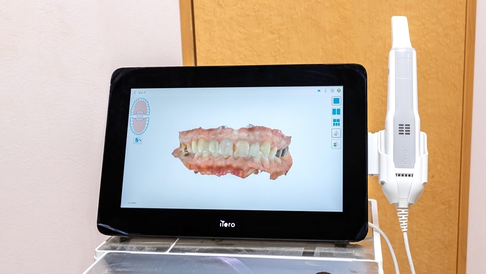 インビザラインでシミュレーション- 奈良県北葛城 矯正歯科相談室