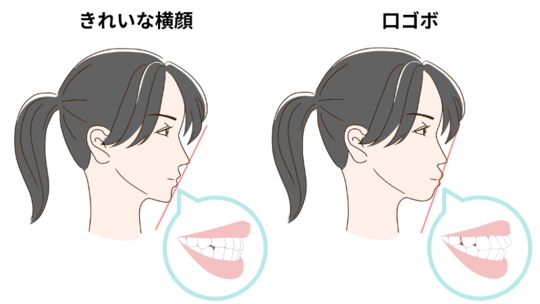 AI任せにすると失敗する？ - 奈良県北葛城 矯正歯科相談室